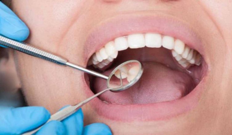 अजब-गजब: चेन्नई के डॉक्टरों ने 7 साल के बच्चे के मुंह से निकाले 526 दांत