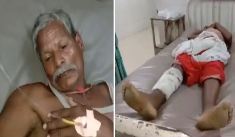 बिहार: डॉक्टरों का कारनामा- हाइड्रोसील की जगह कर दिया पैर का ऑपरेशन