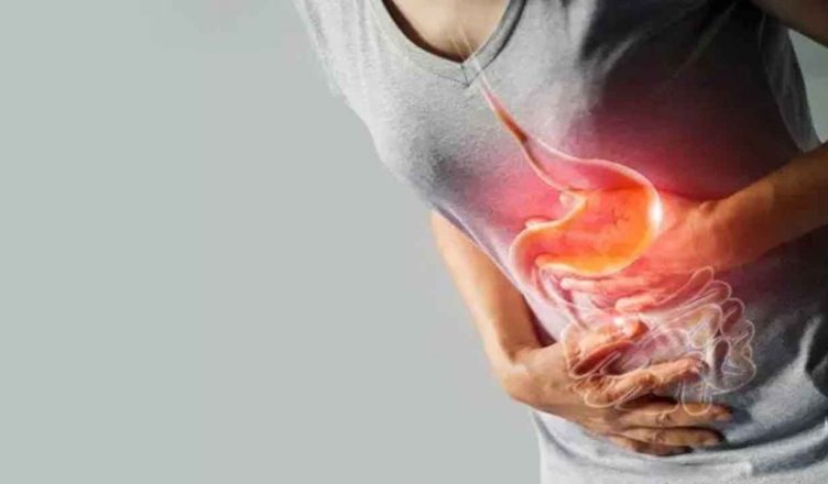 These home remedies relieve stomach gas and severe pain
